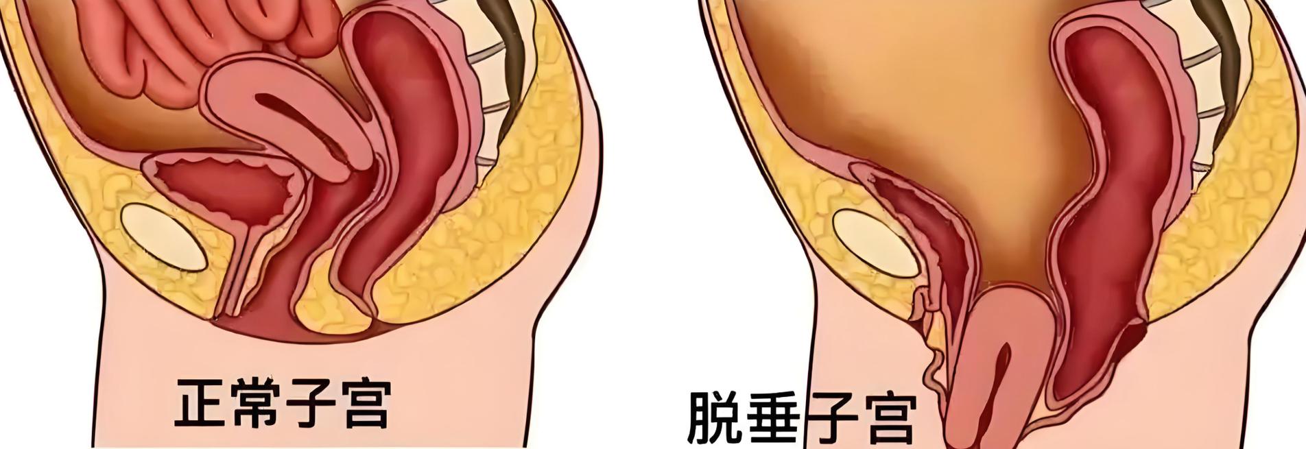 怀孕期间感觉子宫下垂，是孕期正常现象还是身体发出的危险信号？-第2张图片-郑州医学网