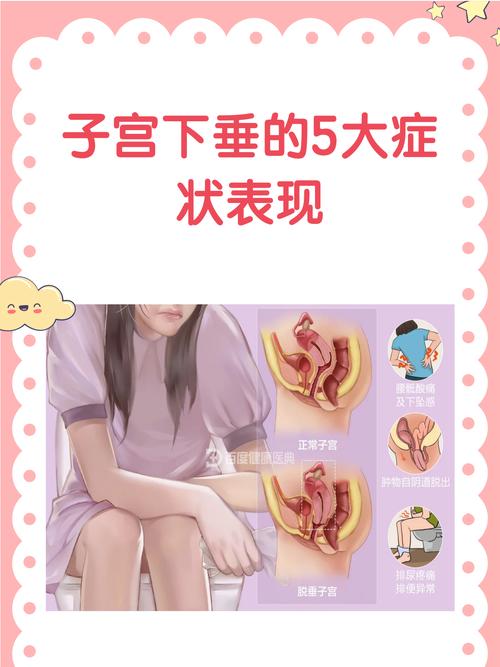 怀孕期间感觉子宫下垂,是孕期正常现象还是身体发出的危险信号?-第1张图片-郑州医学网 怀孕期间感觉子宫下垂,是孕期正常现象还是身体发出的危险信号?-第1张图片-郑州医学网