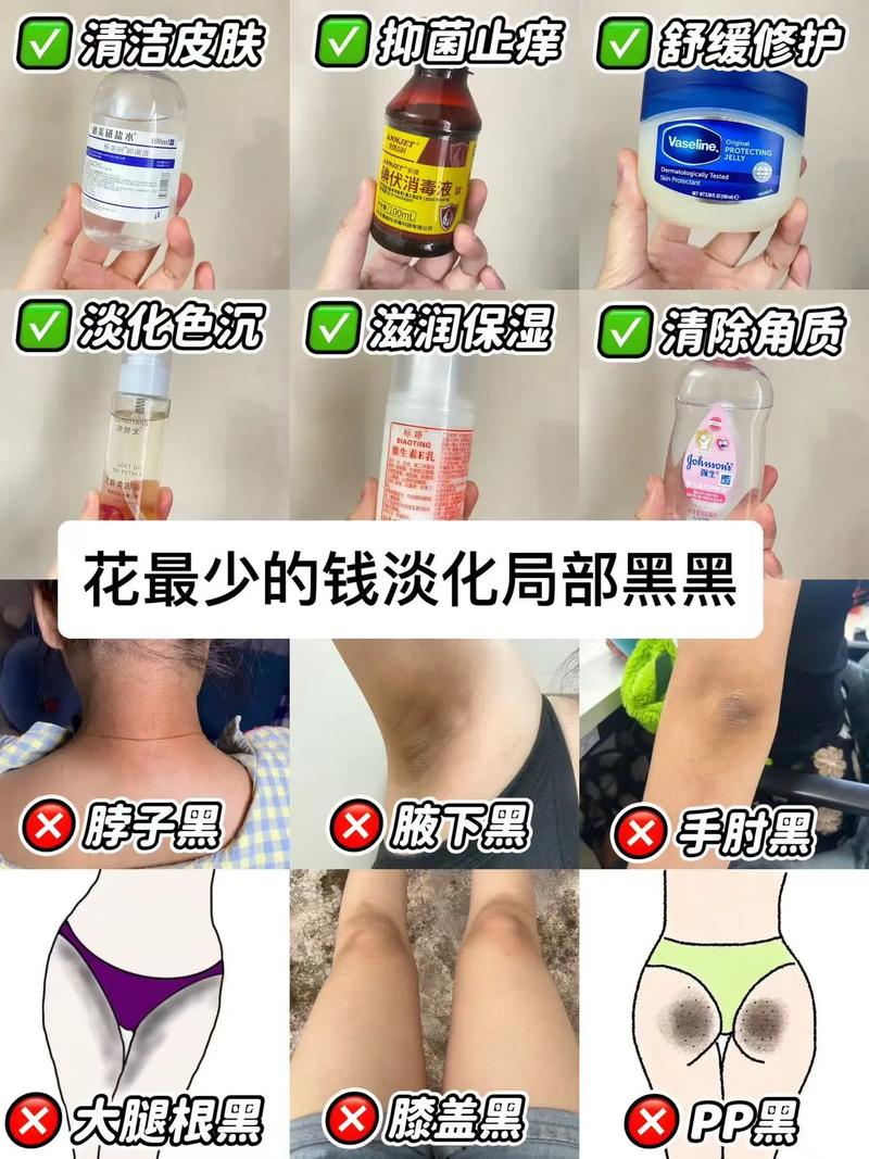 孕期黑色素沉淀会随时间自然消退吗?一般需要多久才能恢复孕前肤色?-第1张图片-郑州医学网 孕期黑色素沉淀会随时间自然消退吗?一般需要多久才能恢复孕前肤色?-第1张图片-郑州医学网