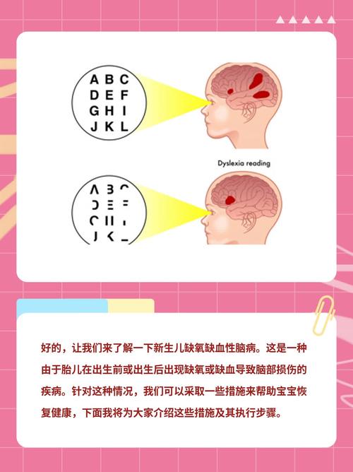 新生儿缺氧缺血性脑病会留下哪些后遗症？如何早期干预和治疗？-第1张图片-郑州医学网