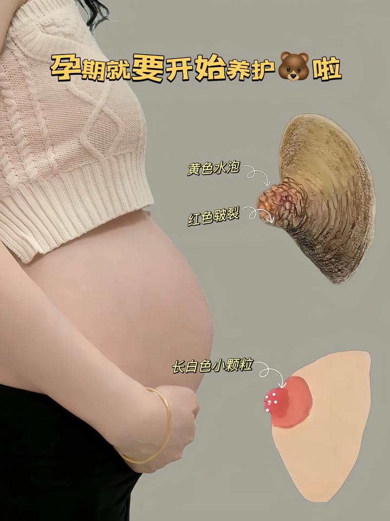 孕期未到预产期却能挤出奶水,是身体异常还是正常生理反应?-第3张图片-郑州医学网 孕期未到预产期却能挤出奶水,是身体异常还是正常生理反应?-第3张图片-郑州医学网