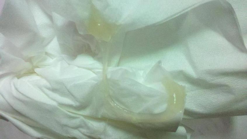 孕期出现乳白色白带是否属于正常现象？-第3张图片-郑州医学网