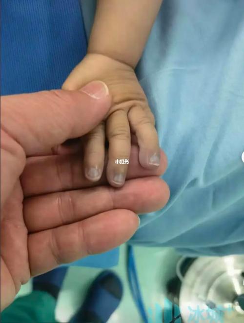 新生儿心脏5毫米小孔需要治疗吗?会影响生长发育吗?-第3张图片-郑州医学网 新生儿心脏5毫米小孔需要治疗吗?会影响生长发育吗?-第3张图片-郑州医学网