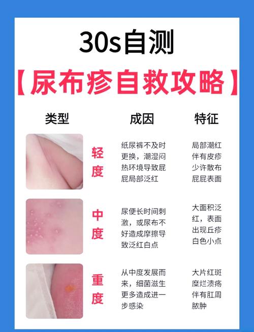 新生儿泌尿系统感染有哪些容易被忽视的异常表现?-第1张图片-郑州医学网 新生儿泌尿系统感染有哪些容易被忽视的异常表现?-第1张图片-郑州医学网