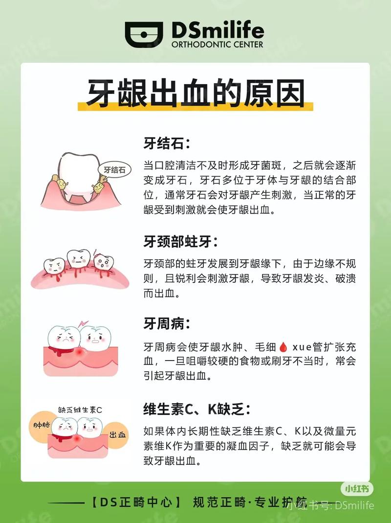 儿童牙龈出血是缺维生素还是刷牙太猛?背后可能隐藏哪些健康问题?-第1张图片-郑州医学网 儿童牙龈出血是缺维生素还是刷牙太猛?背后可能隐藏哪些健康问题?-第1张图片-郑州医学网