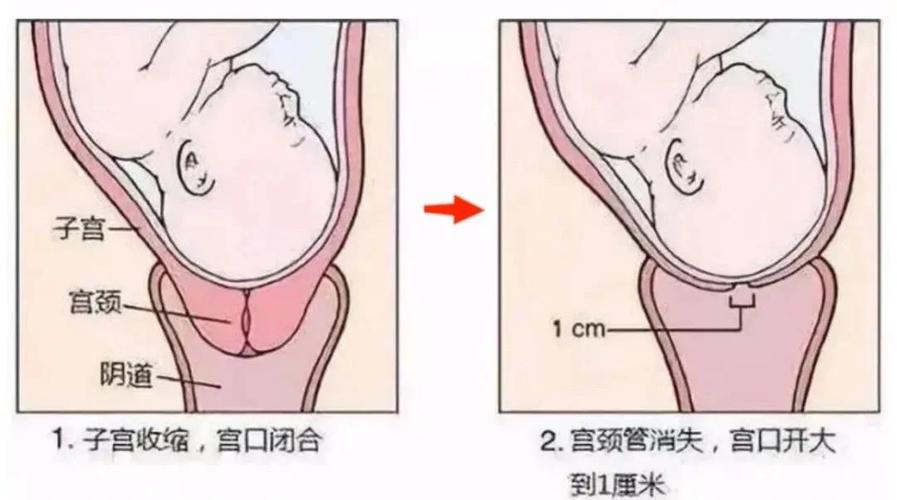 怀孕期间子宫位置如何变化，对孕妇身体有哪些具体影响？-第2张图片-郑州医学网