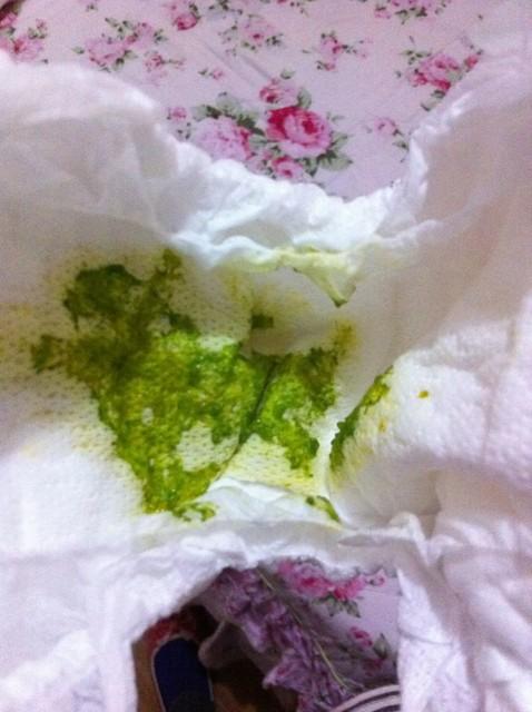 新生儿的大便为何呈现绿色？是正常现象还是健康预警？-第2张图片-郑州医学网