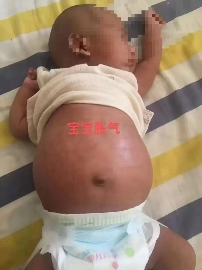 15天新生儿肚子老咕噜叫是正常现象还是消化问题?需要担心吗?-第2张图片-郑州医学网 15天新生儿肚子老咕噜叫是正常现象还是消化问题?需要担心吗?-第2张图片-郑州医学网