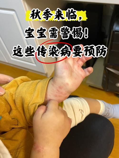 新生儿感染疫情后会有哪些症状?家长该如何科学护理与预防?-第1张图片-郑州医学网 新生儿感染疫情后会有哪些症状?家长该如何科学护理与预防?-第1张图片-郑州医学网