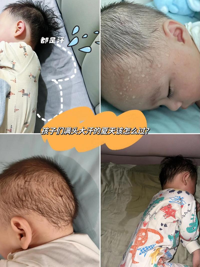 20天新生儿受凉会有哪些症状?如何判断和处理?-第1张图片-郑州医学网 20天新生儿受凉会有哪些症状?如何判断和处理?-第1张图片-郑州医学网