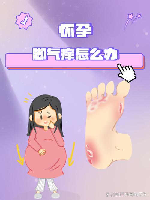 孕期脚心痒得受不了,是缺营养还是激素捣乱?怎么止痒才安全?-第1张图片-郑州医学网 孕期脚心痒得受不了,是缺营养还是激素捣乱?怎么止痒才安全?-第1张图片-郑州医学网