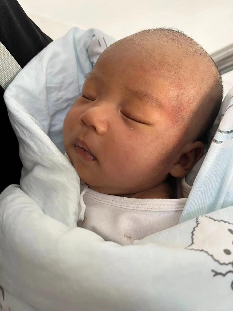 新生儿一个月了黄疸还没退，正常吗？需要怎么处理？-第1张图片-郑州医学网