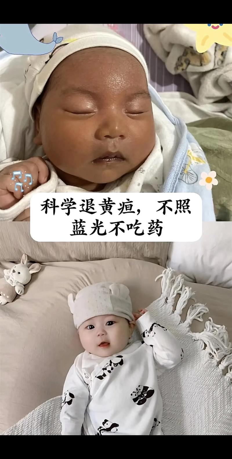 新生儿一个月了黄疸还没退，正常吗？需要怎么处理？-第3张图片-郑州医学网