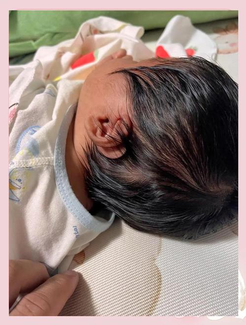 儿童头发发黄是营养不良还是疾病信号？家长该如何科学应对？-第3张图片-郑州医学网