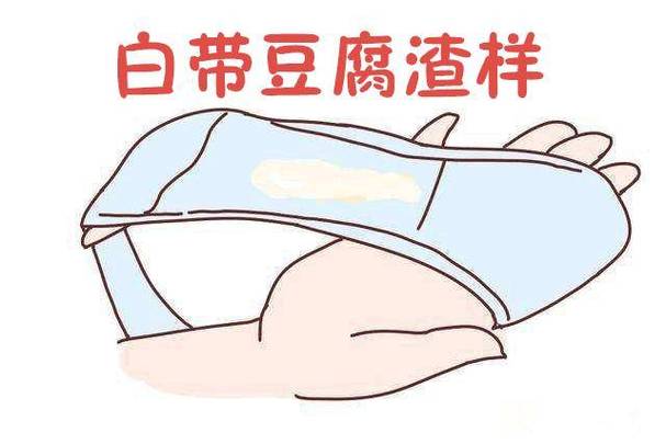 孕期正常的分泌物颜色有哪些?不同颜色分别代表什么健康信号?-第3张图片-郑州医学网 孕期正常的分泌物颜色有哪些?不同颜色分别代表什么健康信号?-第3张图片-郑州医学网