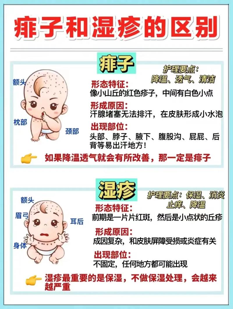 新生儿身上长痱子别慌！这些护理妙招和注意事项新手爸妈必看？-第1张图片-郑州医学网