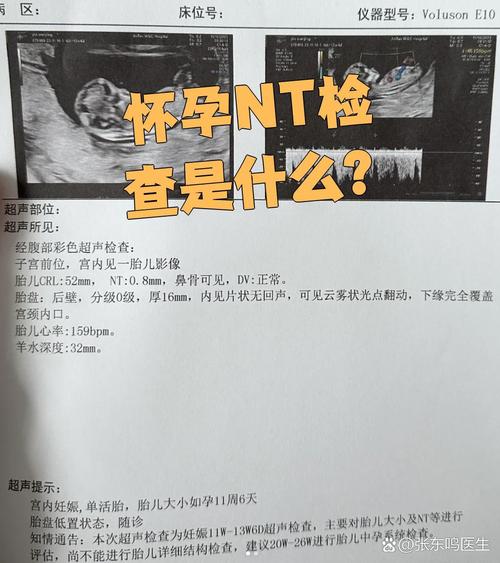 孕期NT检查需要憋尿吗?不同孕周有不同要求吗?-第3张图片-郑州医学网 孕期NT检查需要憋尿吗?不同孕周有不同要求吗?-第3张图片-郑州医学网