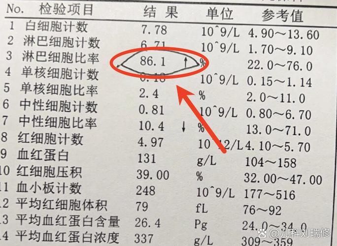 儿童淋巴细胞绝对值偏高是生病了吗？需要治疗吗？家长该怎么办？-第1张图片-郑州医学网