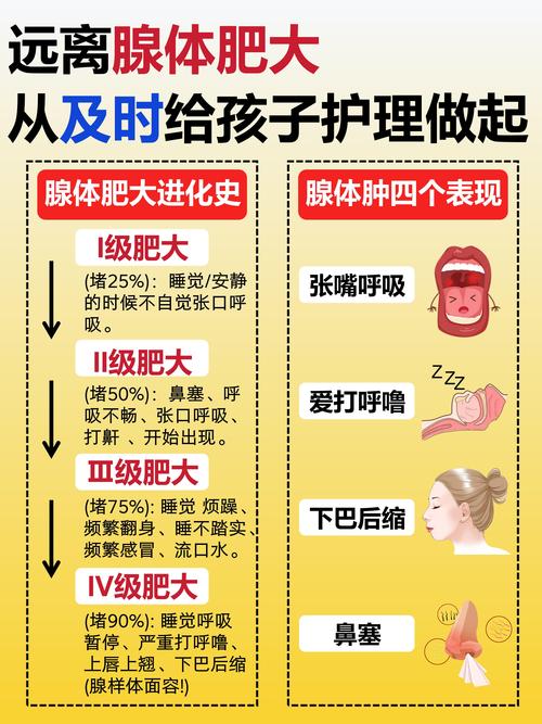 儿童腺样体肥大保守治疗有效吗？有哪些方法？什么情况需要手术？-第1张图片-郑州医学网