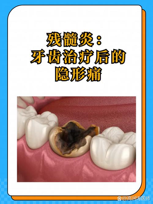 孕期牙髓炎疼得睡不着，到底能不能治？对胎儿有影响吗？-第3张图片-郑州医学网