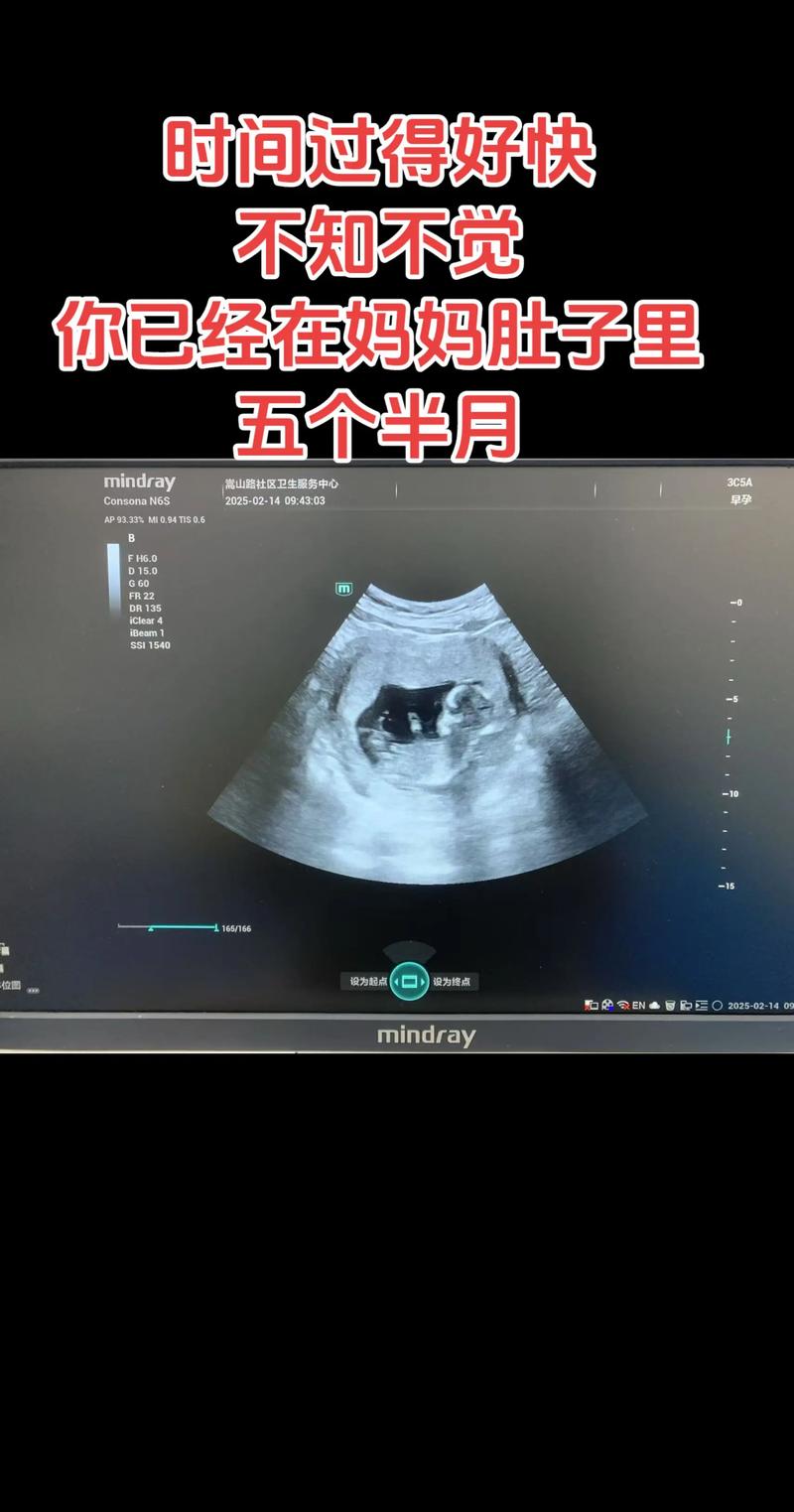 怀孕五月胎儿发育到什么程度了？B超能看清哪些细节？-第2张图片-郑州医学网