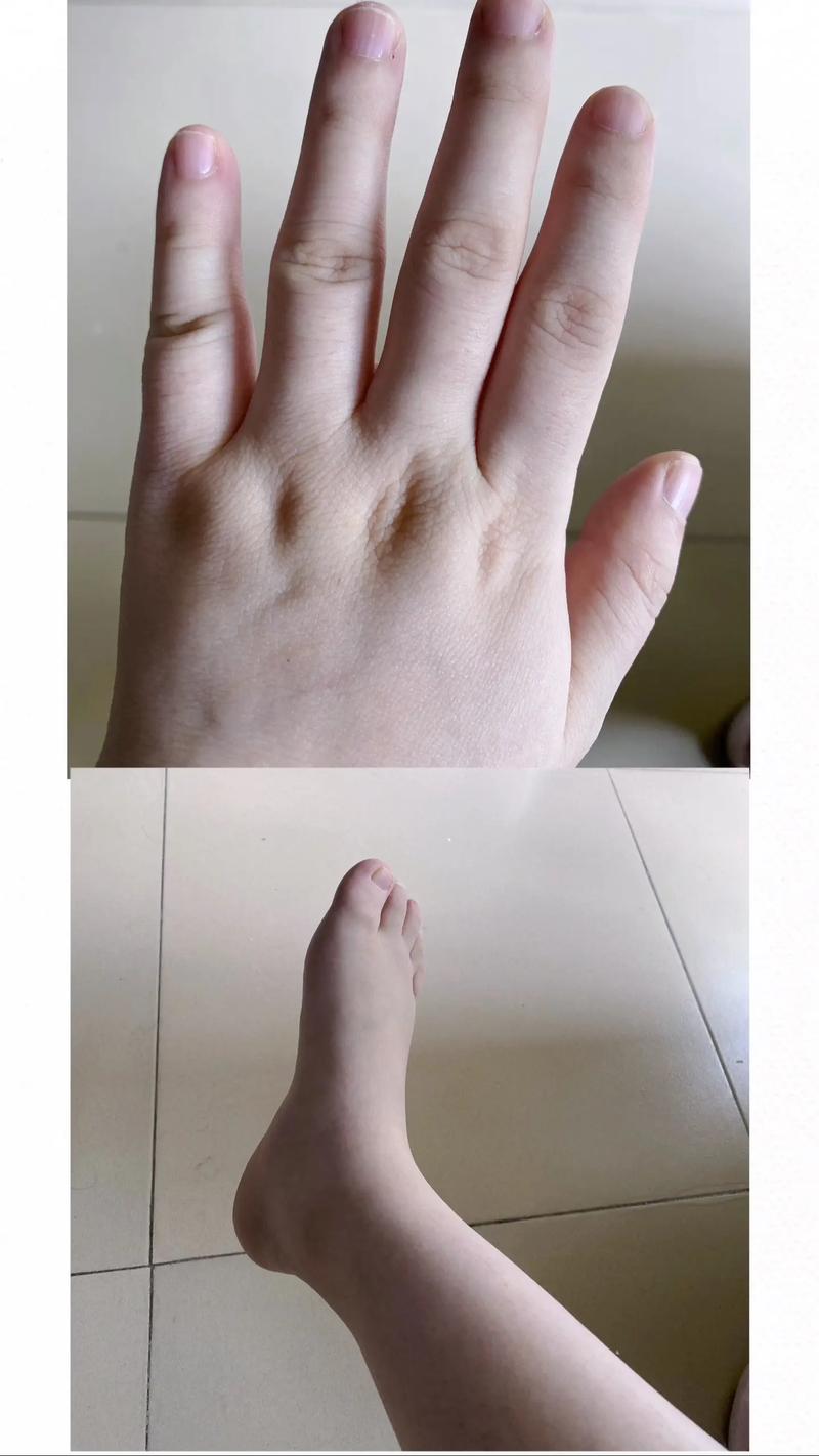 孕期便秘导致下体肿胀，该如何缓解并预防肛肠损伤？-第3张图片-郑州医学网