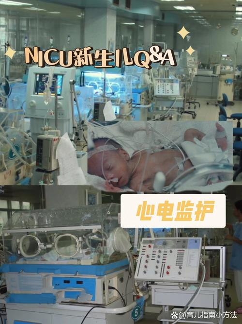 新生儿缺氧必须做CT检查吗?有没有更安全的替代方案?-第3张图片-郑州医学网 新生儿缺氧必须做CT检查吗?有没有更安全的替代方案?-第3张图片-郑州医学网