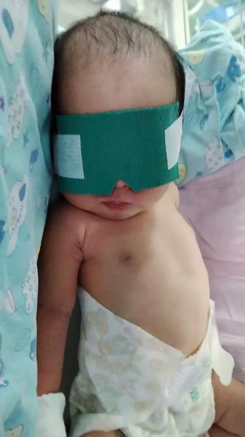 新生儿出生四天黄疸18mg/dL需要立即干预吗？-第1张图片-郑州医学网