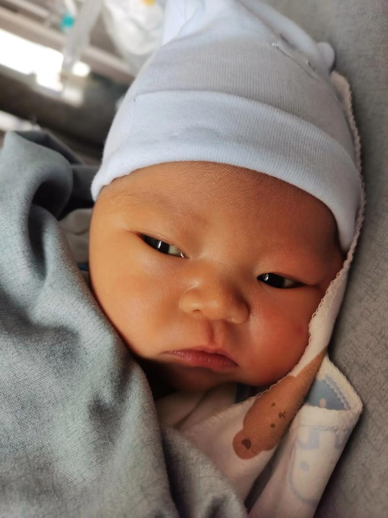 新生儿出生四天黄疸18mg/dL需要立即干预吗？-第3张图片-郑州医学网