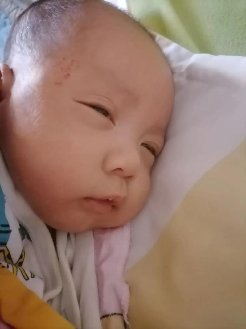 新生儿甲状腺功能低下症会影响宝宝发育吗?早发现早干预能避免哪些后遗症?-第3张图片-郑州医学网 新生儿甲状腺功能低下症会影响宝宝发育吗?早发现早干预能避免哪些后遗症?-第3张图片-郑州医学网