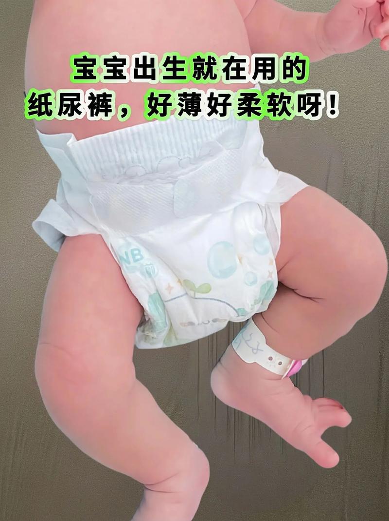 新生儿尿不湿怎么选？柔软度、吸水性、透气性哪个更重要？-第2张图片-郑州医学网