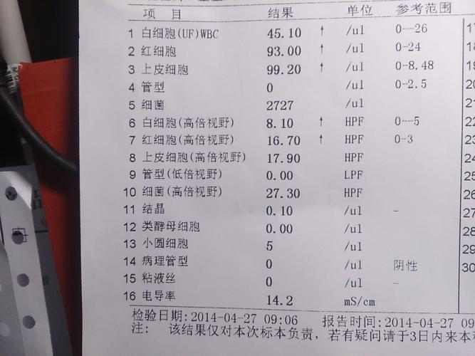 孕期尿常规葡萄糖14mmol/L是糖尿病吗？需要做糖耐量检查吗？-第3张图片-郑州医学网