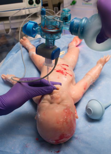 无线网辐射真的会危害新生儿健康吗?科学依据在哪里?-第1张图片-郑州医学网 无线网辐射真的会危害新生儿健康吗?科学依据在哪里?-第1张图片-郑州医学网