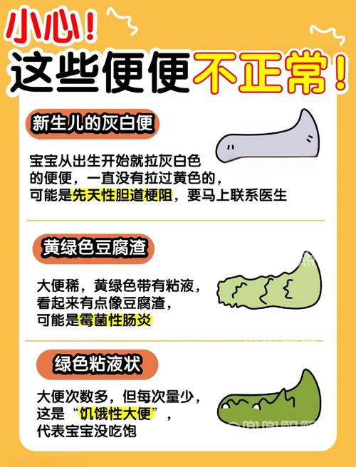 新生儿不大便究竟是什么原因导致的?是正常生理现象还是潜在健康问题的信号?-第2张图片-郑州医学网 新生儿不大便究竟是什么原因导致的?是正常生理现象还是潜在健康问题的信号?-第2张图片-郑州医学网