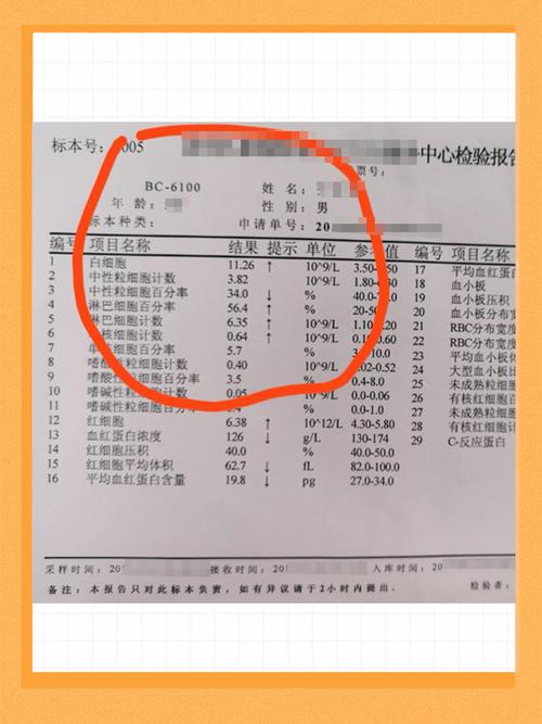 儿童淋巴细胞百分比偏高是哪些原因导致的？需要治疗吗？-第1张图片-郑州医学网