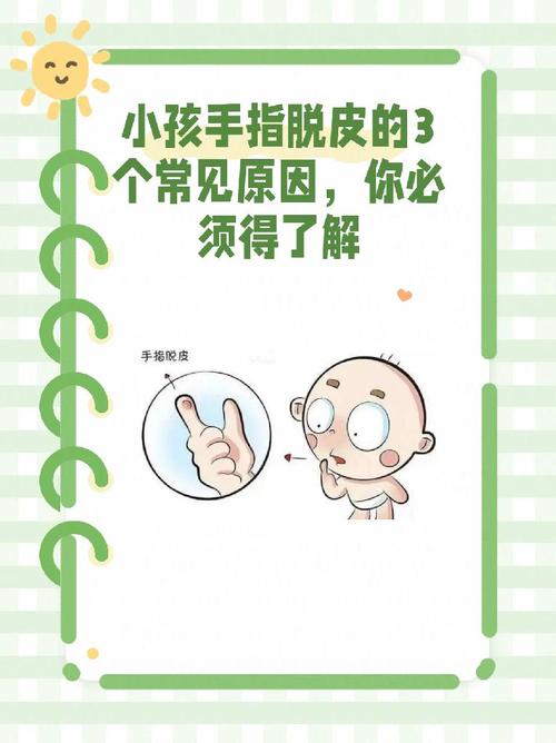 新生儿长6个手指头是什么原因导致的？是遗传因素还是孕期环境影响？-第3张图片-郑州医学网