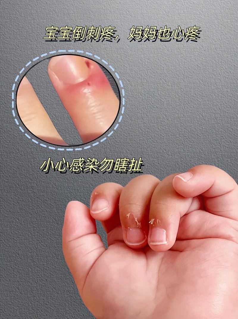 新生儿长6个手指头是什么原因导致的？是遗传因素还是孕期环境影响？-第2张图片-郑州医学网