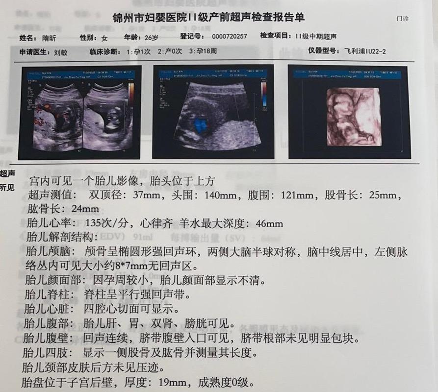 孕期三维检查具体包含哪些项目？能排查哪些胎儿畸形问题？-第2张图片-郑州医学网