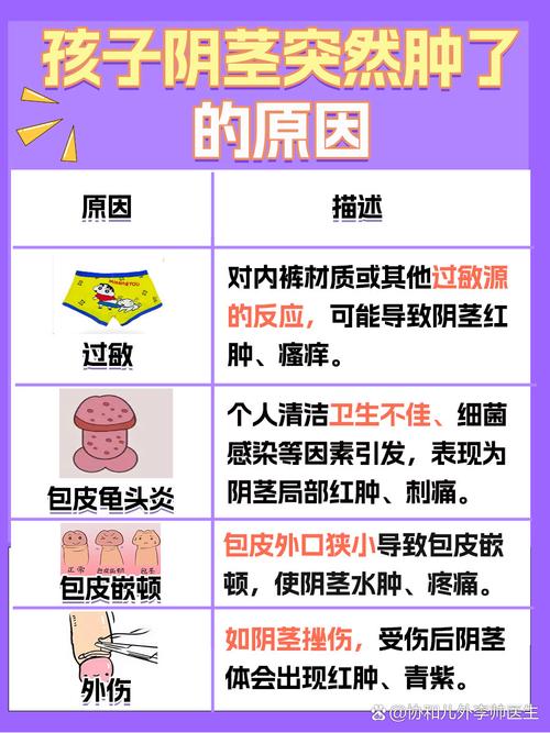 儿童小鸡痒痒是怎么回事?需要警惕哪些疾病或日常护理问题?-第1张图片-郑州医学网 儿童小鸡痒痒是怎么回事?需要警惕哪些疾病或日常护理问题?-第1张图片-郑州医学网