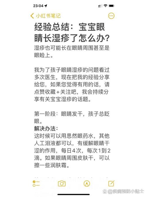 新生儿眼角湿疹反复发作，日常护理与用药该如何正确处理？-第1张图片-郑州医学网