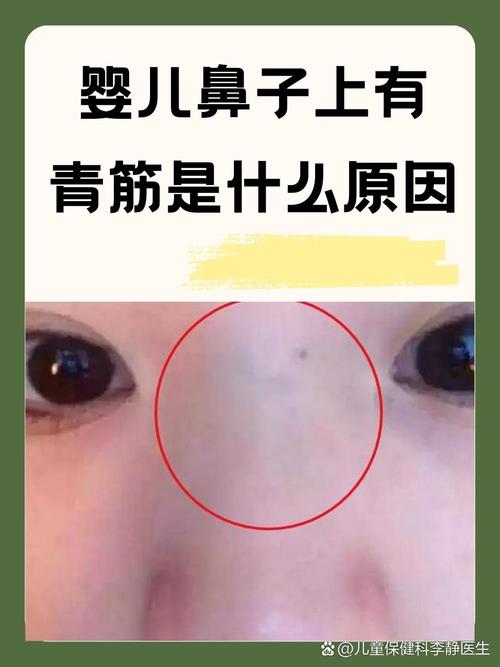 新生儿人中发青是缺氧还是血液循环异常？需警惕哪些潜在健康问题？-第1张图片-郑州医学网