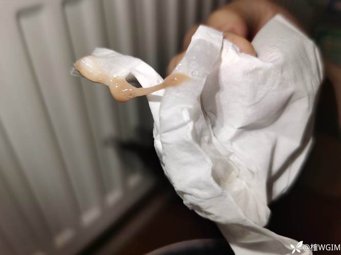 新生儿20天喉咙有痰咳不出怎么办？需要担心什么问题吗？-第2张图片-郑州医学网