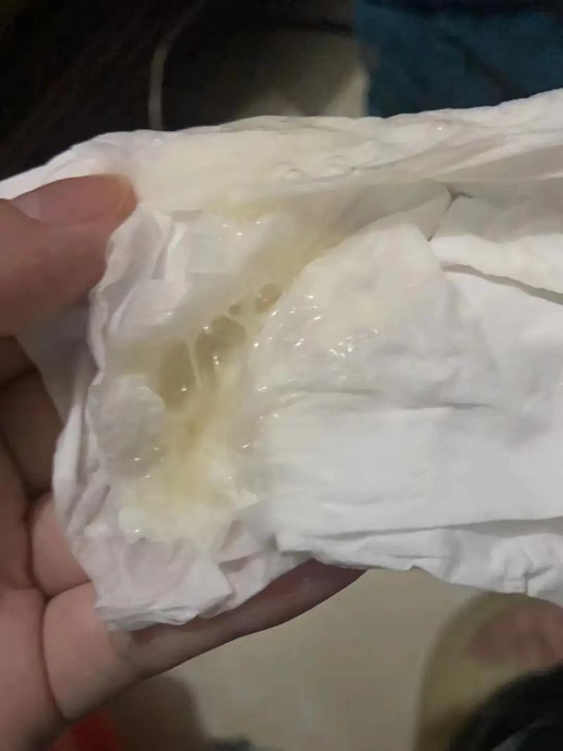 新生儿20天喉咙有痰咳不出怎么办？需要担心什么问题吗？-第1张图片-郑州医学网