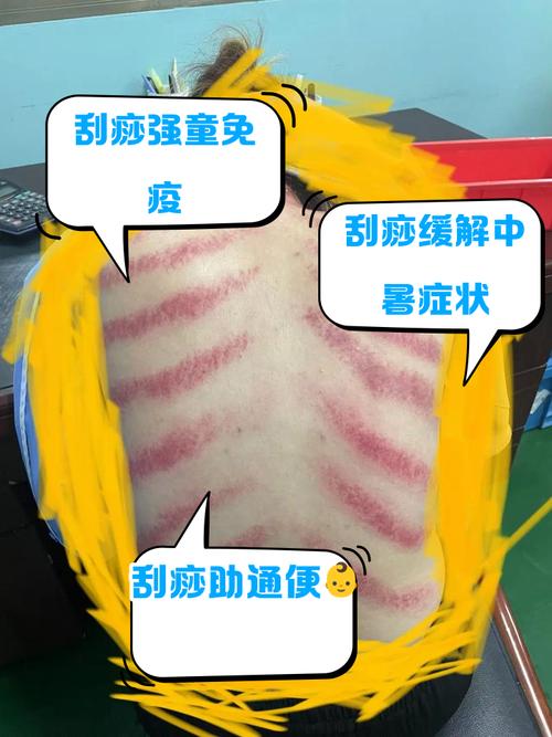 儿童出沙子后家长该如何正确处理与护理？-第2张图片-郑州医学网