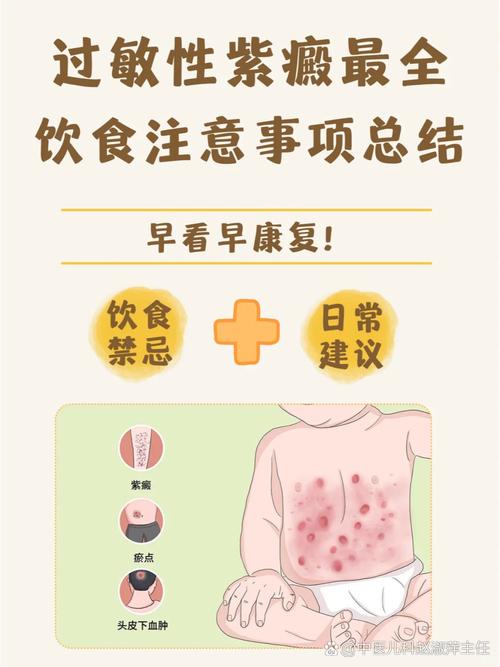 儿童紫癜有哪些科学有效的治疗方法?如何预防复发与日常护理?-第1张图片-郑州医学网 儿童紫癜有哪些科学有效的治疗方法?如何预防复发与日常护理?-第1张图片-郑州医学网