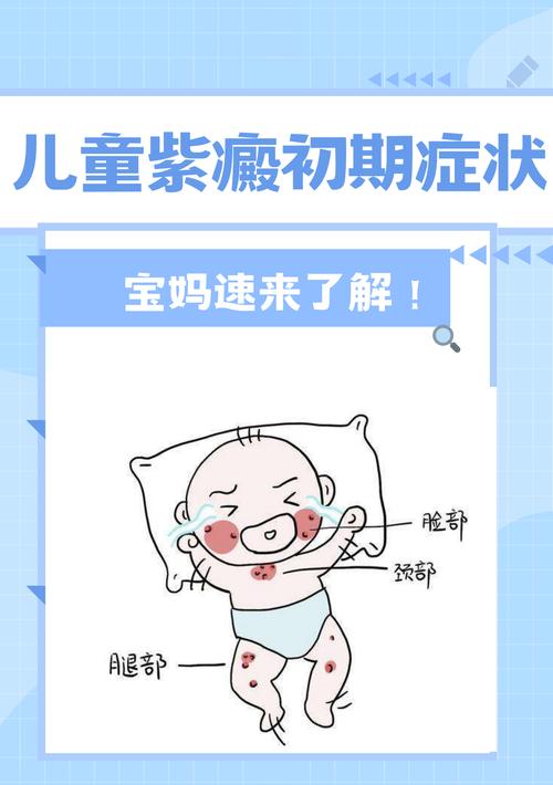 儿童紫癜有哪些科学有效的治疗方法?如何预防复发与日常护理?-第2张图片-郑州医学网 儿童紫癜有哪些科学有效的治疗方法?如何预防复发与日常护理?-第2张图片-郑州医学网