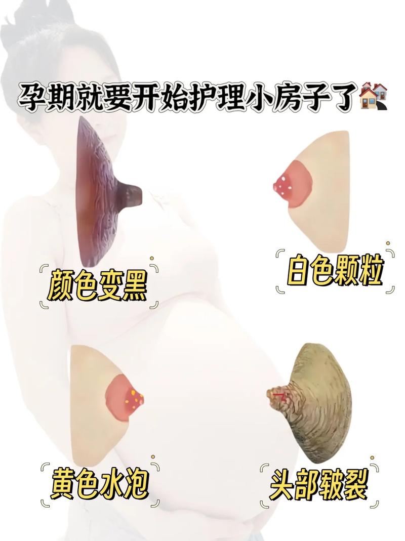 孕期和哺乳期乳房都会变大,哪个阶段增长更明显?原因是什么?-第2张图片-郑州医学网 孕期和哺乳期乳房都会变大,哪个阶段增长更明显?原因是什么?-第2张图片-郑州医学网