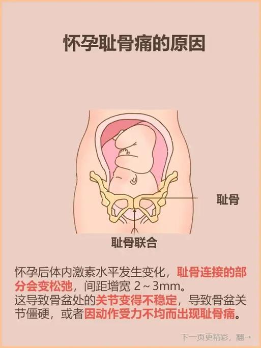 孕期几个月开始耻骨疼?疼痛原因与缓解方法有哪些?-第1张图片-郑州医学网 孕期几个月开始耻骨疼?疼痛原因与缓解方法有哪些?-第1张图片-郑州医学网