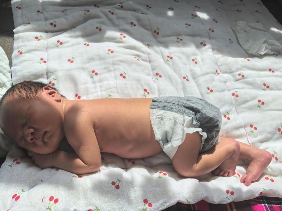 新生儿黄疸晒太阳,晒多久、怎么晒才最有效且安全?-第2张图片-郑州医学网 新生儿黄疸晒太阳,晒多久、怎么晒才最有效且安全?-第2张图片-郑州医学网