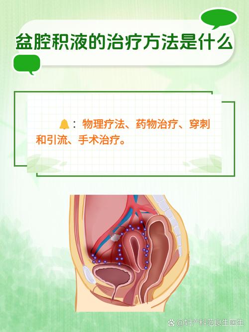 备孕期查出盆腔积液会影响怀孕吗？需要治疗吗？-第1张图片-郑州医学网